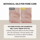 روغن پاکسازی و کنترل منافذ ماداسگار سنتلا Centella حجم 200 میل